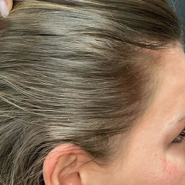 Emily J. after 3 months