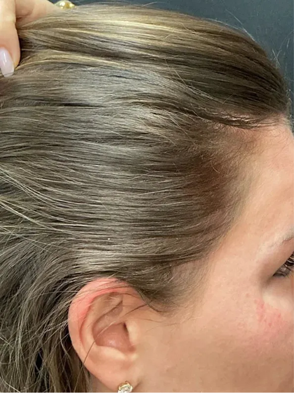 before-img