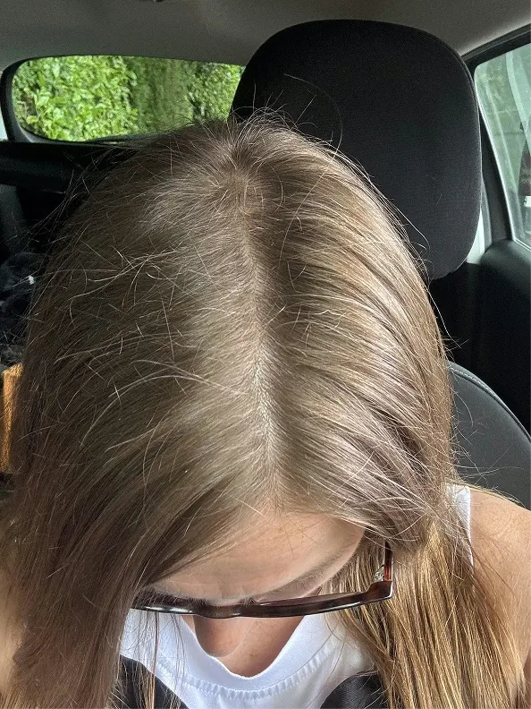 after-img