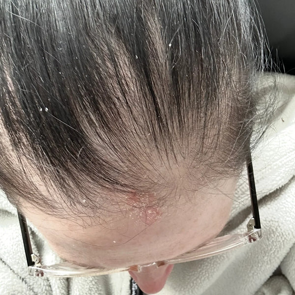 Clare D. on day 1