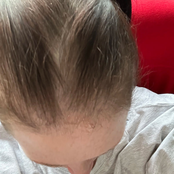 Clare D. after 3 months