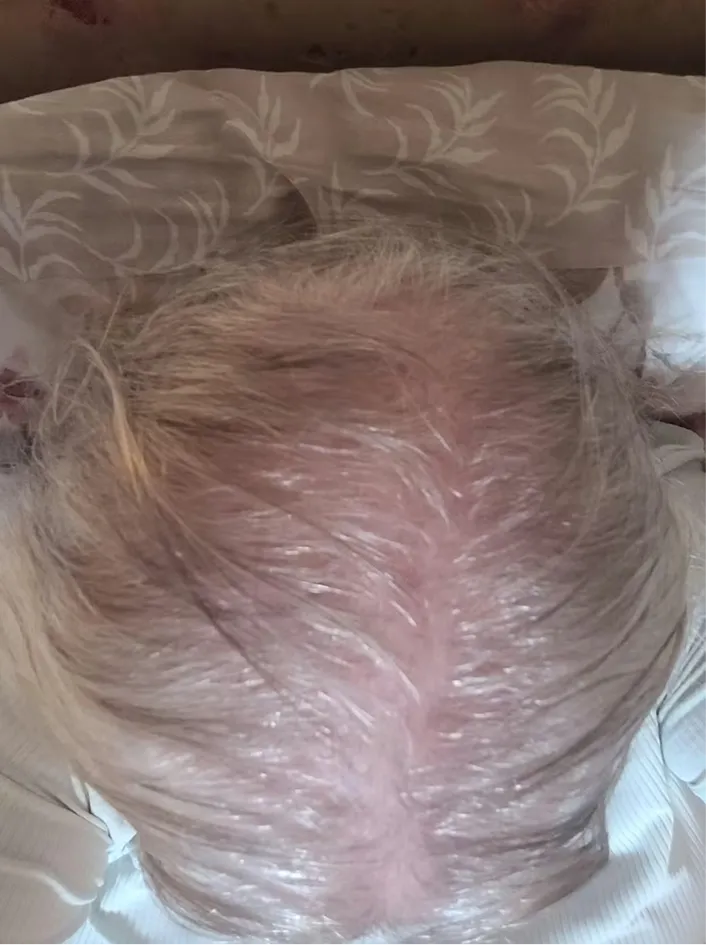 before-img